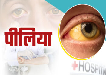 बडू में पीलिया का प्रकोप 47 मामले आए सामने, विभाग ने जारी किया नोटिस